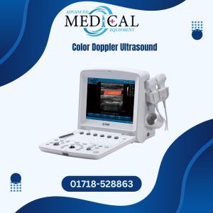 Color Doppler Ultrasound